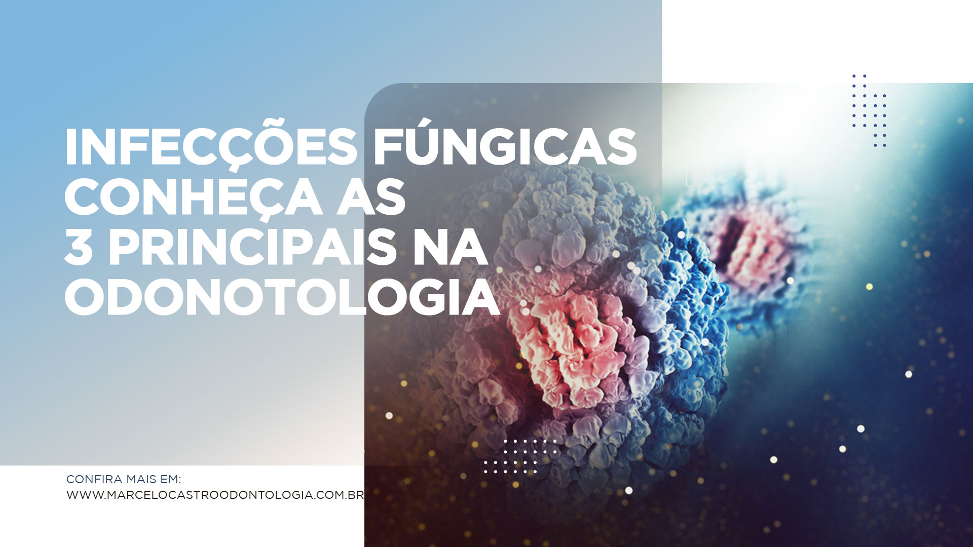 Thumbnail-Infecções-Fúngicas