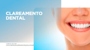 Thumbnail-clareamento-dental