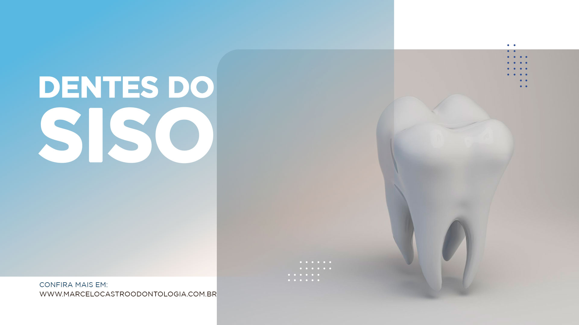 Thumbnail-dentes-do-siso