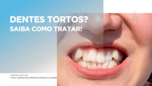 Thumbnail-dentes-tortos